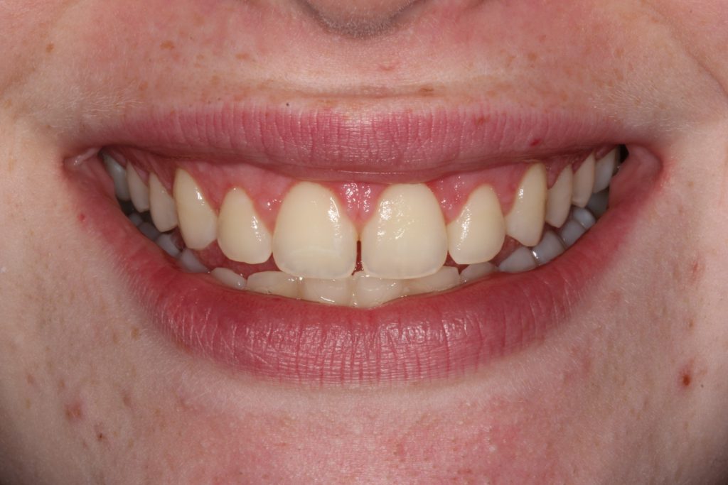 Smile Gallery