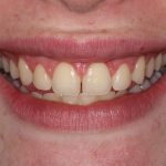 Smile Gallery