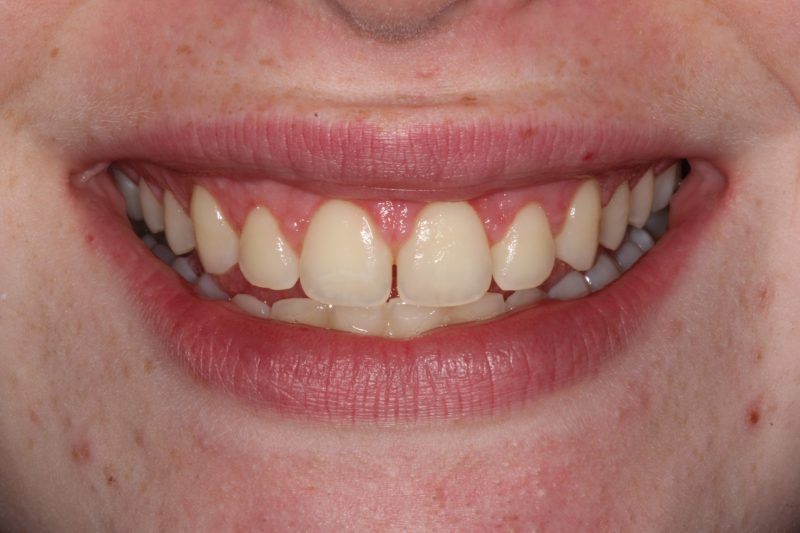 Smile Gallery