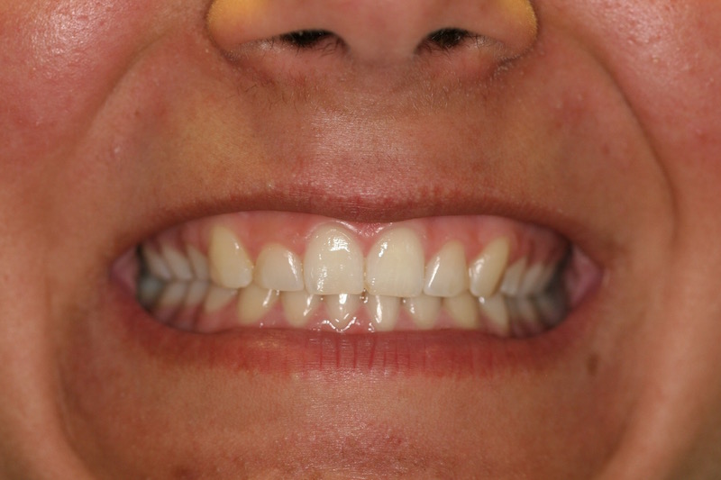Smile Gallery