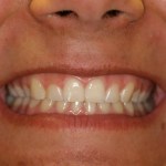 Smile Gallery