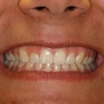 Smile Gallery