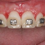 Smile Gallery