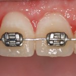 Smile Gallery