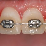 Smile Gallery