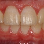 Smile Gallery
