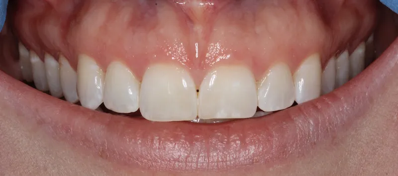 Smile Gallery