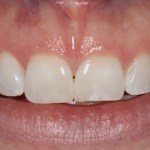 Smile Gallery