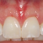 Smile Gallery