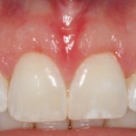 Smile Gallery