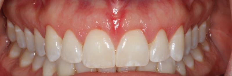 Smile Gallery