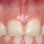 Smile Gallery