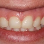 Smile Gallery