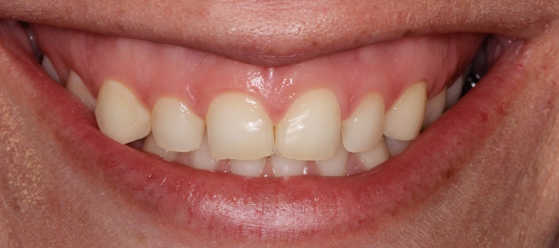 Smile Gallery
