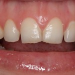 Smile Gallery