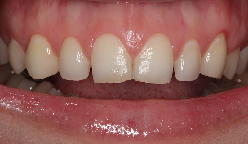 Smile Gallery