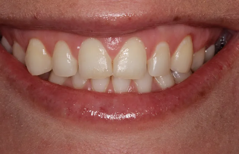 Smile Gallery