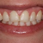 Smile Gallery