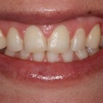 Smile Gallery