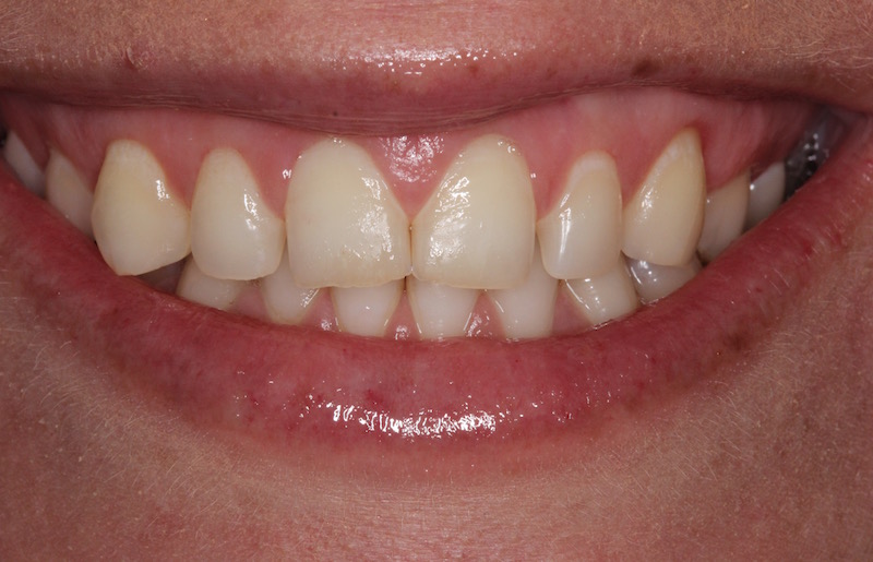 Smile Gallery