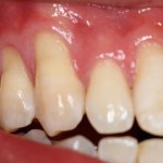 Smile Gallery