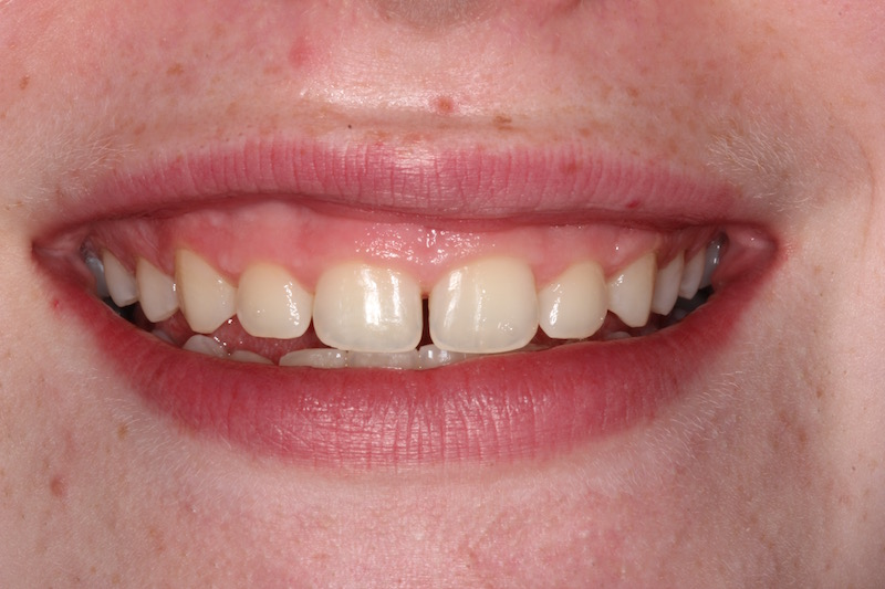 Smile Gallery