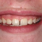 Smile Gallery