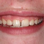 Smile Gallery