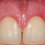 Smile Gallery